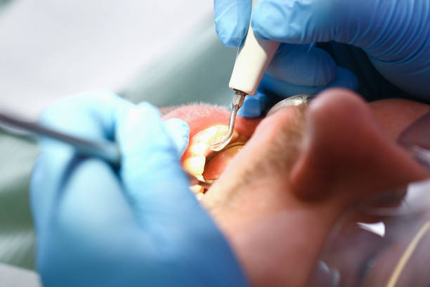Best Emergency Dental Surgery in Keene, TX