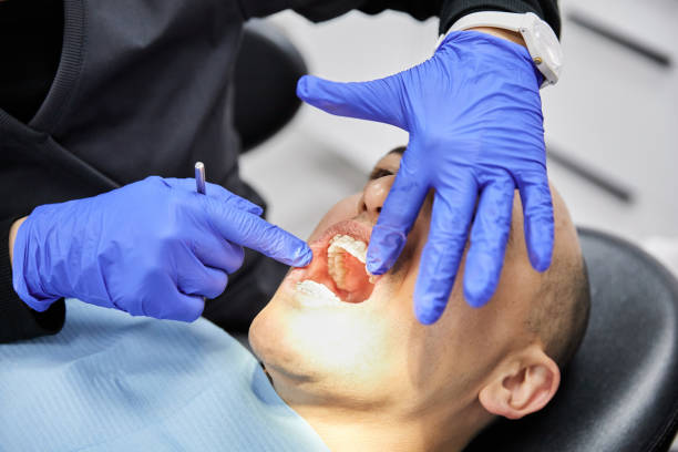 Best Emergency Tooth Extraction in Keene, TX