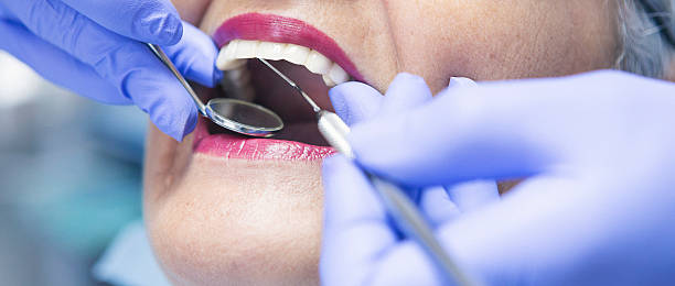 Best Emergency Wisdom Teeth Removal in Keene, TX